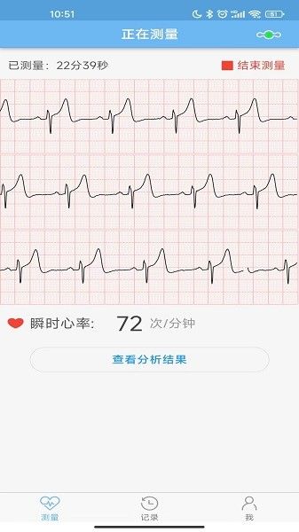 數(shù)維康心電(SwayCore)